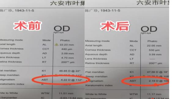 1eeec76ca7a8636e84a226cbe3317c1
